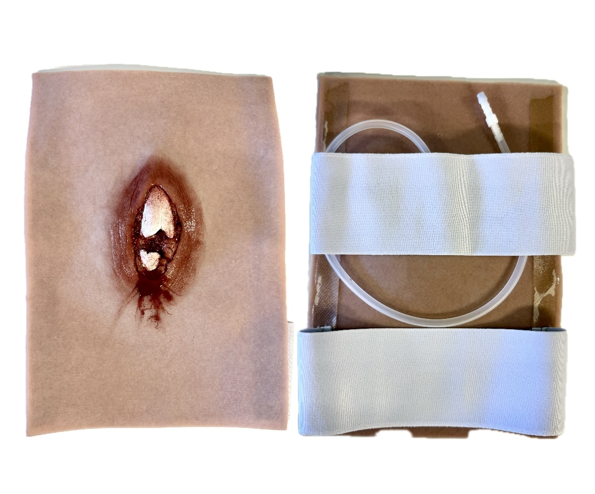 Reisiluun avomurtuma SRP