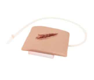 Käsivarren viiltohaava SRP